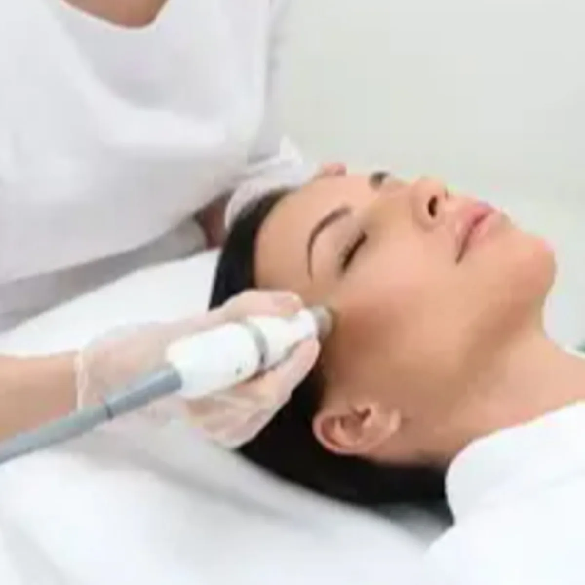 Before Botox® Cosmetic Results